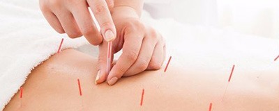 春日部駅前鍼灸整骨院の写真5枚目: