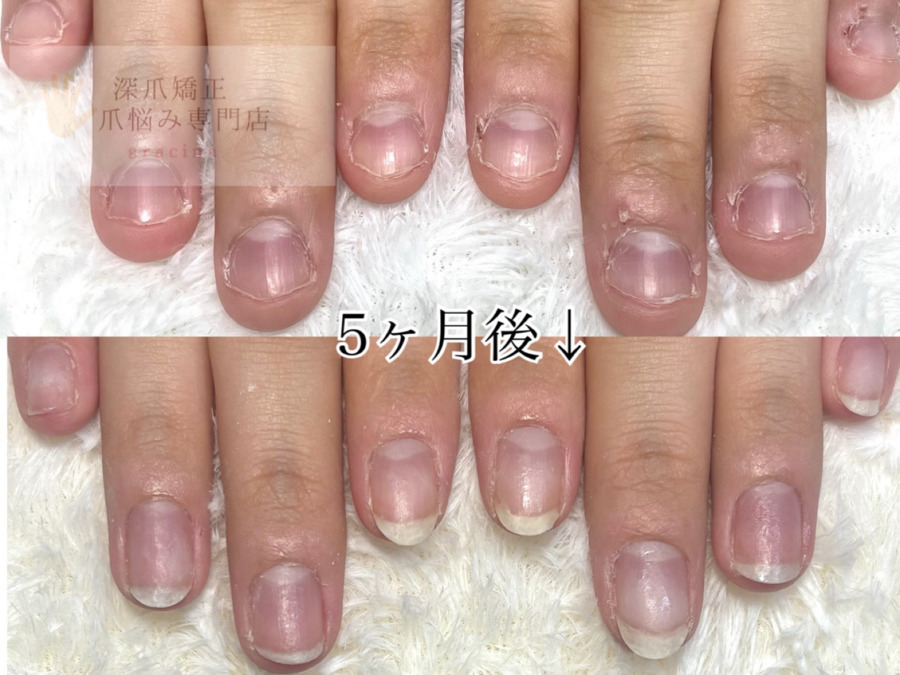 深爪矯正爪悩み専門店　グラシナ　烏丸店【2025年05月11日オープン】（ネイリストの求人）の写真5枚目：