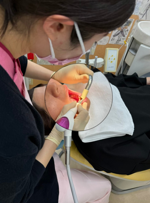 チャイルドデンタル ほし歯科医院の写真19枚目:エアフロ-によるクリ-ニング