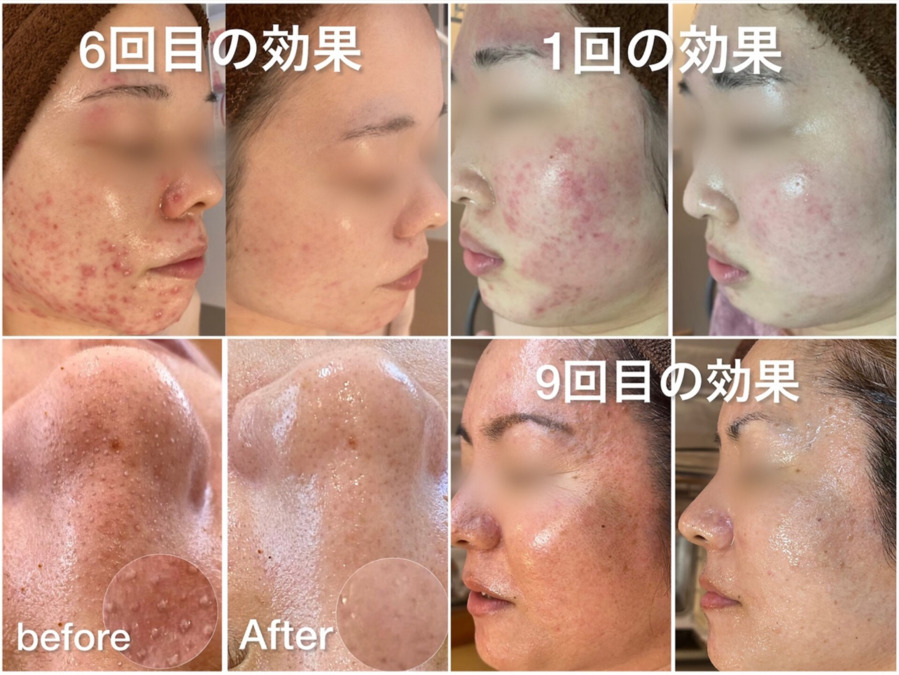 NAskin 北谷店(エステティシャン/セラピストの求人)の写真3枚目: