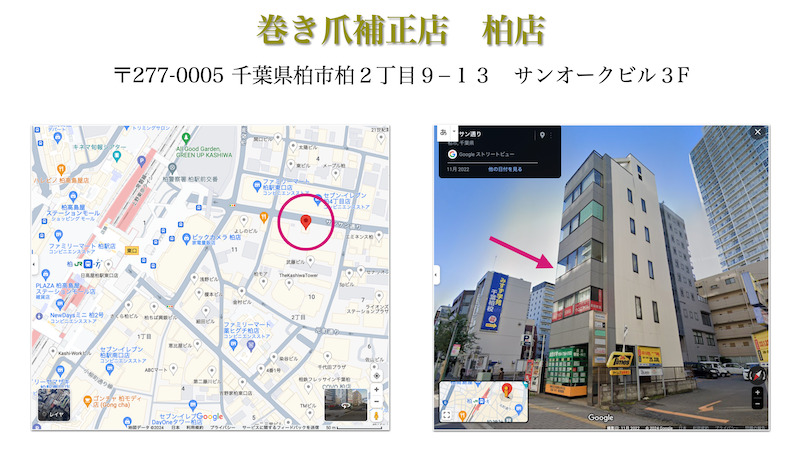 巻き爪補正店 柏店の写真5枚目：