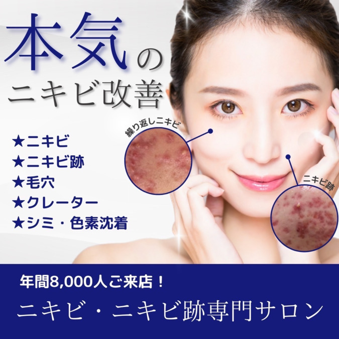 ニキビ研究所　浦和店【2026年02月01日オープン予定】の写真2枚目：