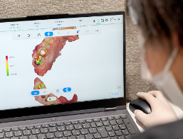 ３Dスキャンデンタル東京の写真10枚目：