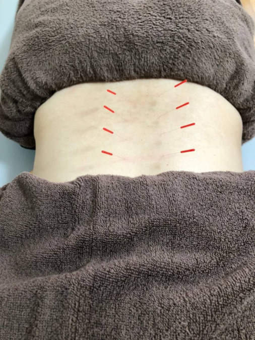 メディハモ鍼灸整骨院(医療事務/受付の求人)の写真17枚目: