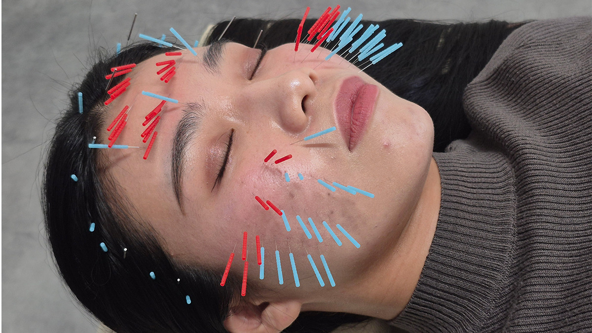 整骨院れん-ＲＥＮ- 日南院の写真