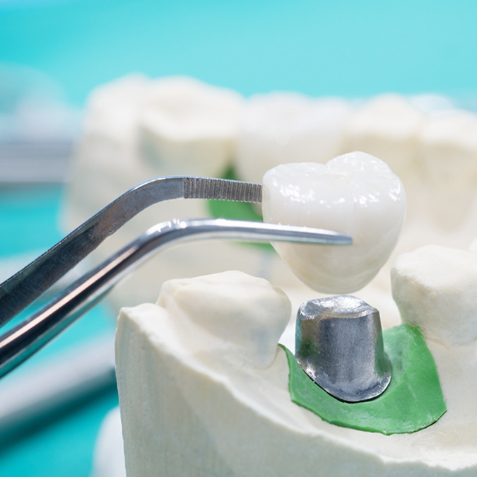 ひかりのテラス技工所（仮称）【2026年秋オープン予定】（歯科技工士の求人）の写真5枚目：技工士さん募集中！！