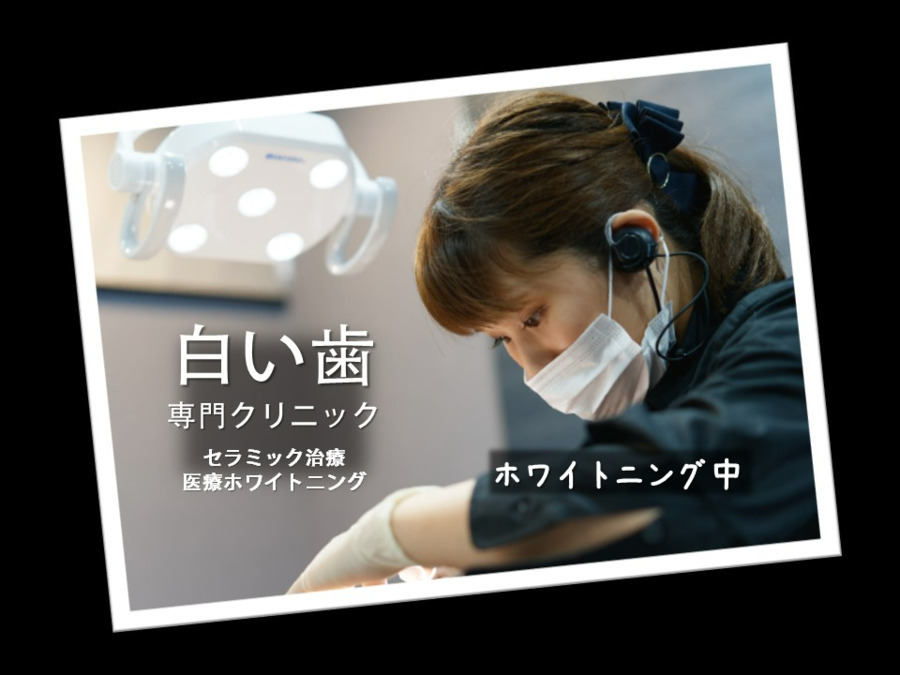 ３Dスキャンデンタル東京の写真11枚目：