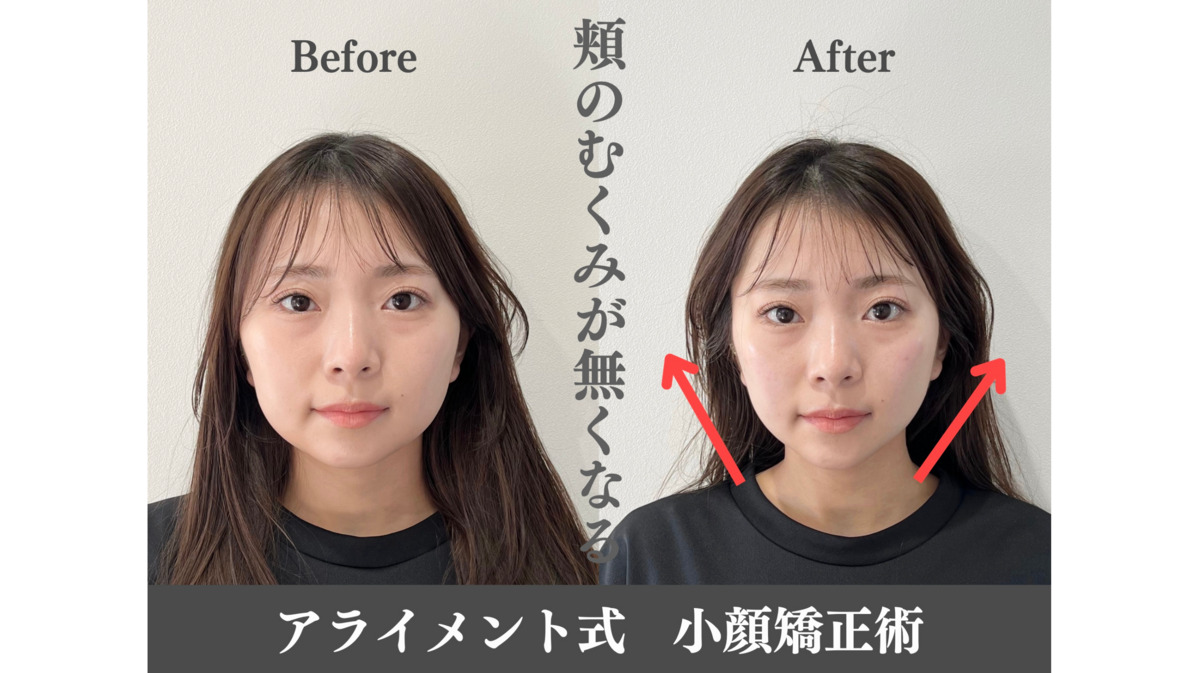 美容整体 AlignmentTOKYO 表参道【2024年11月オープン】（整体師の求人）の写真5枚目：