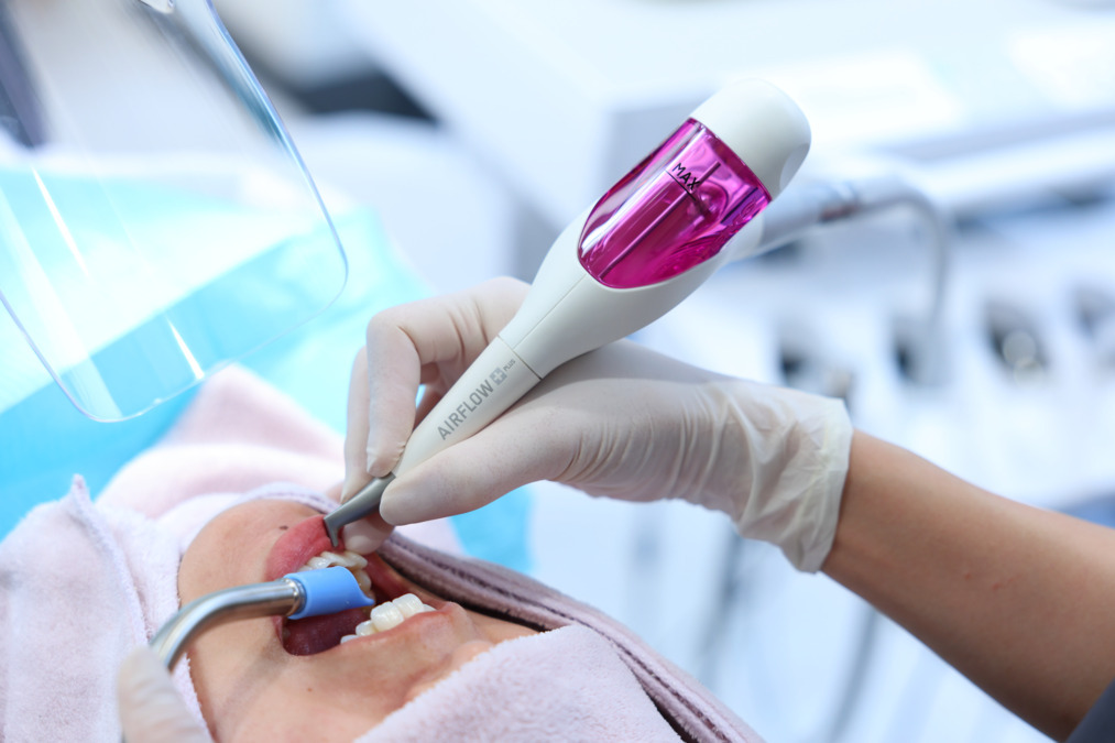 南行徳駅前歯医者スワンデンタルクリニック【2025年06月03日オープン】の写真8枚目:⭐︎パウダークリーニング⭐︎