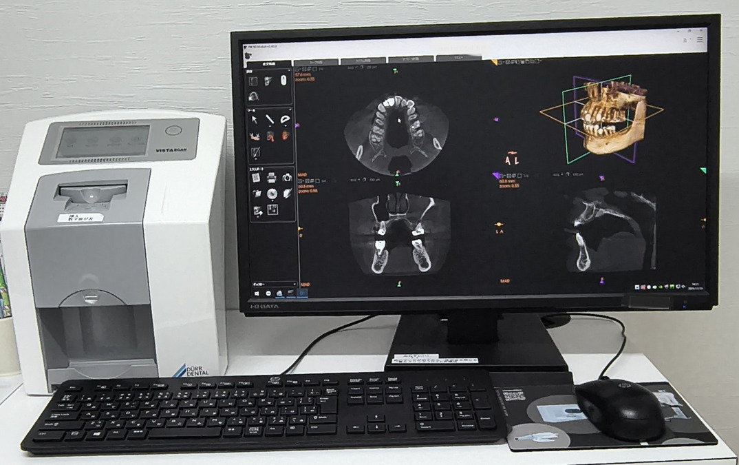 今枝歯科医院(歯科衛生士の求人)の写真3枚目:歯科用CTスキャナ完備