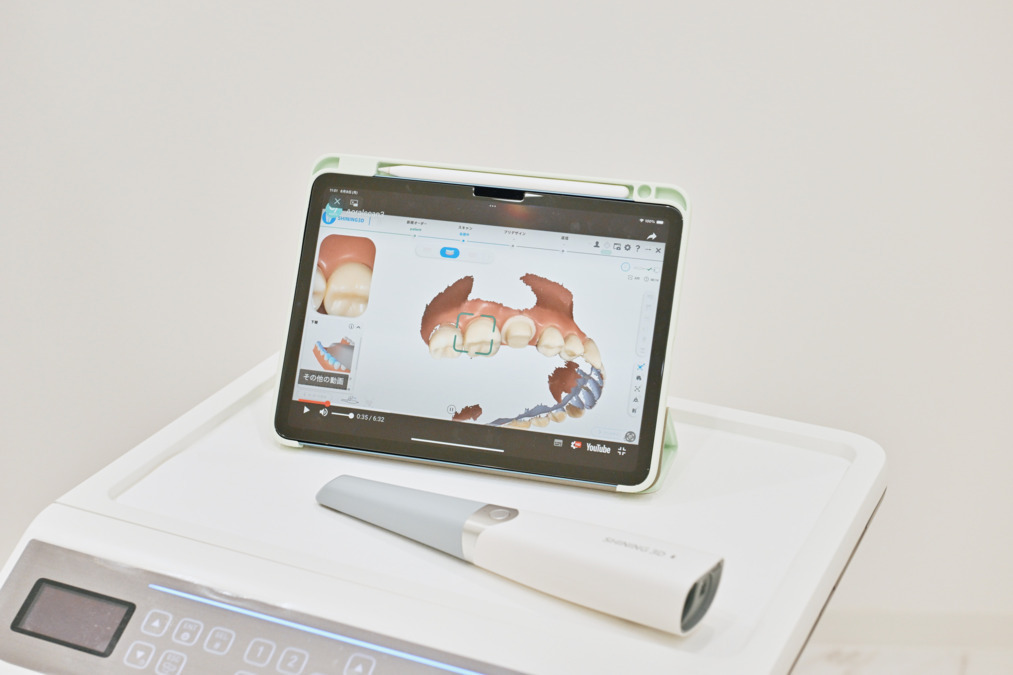 みわファミリーデンタルクリニック【2025年06月オープン】の写真9枚目:口腔内スキャナーがあり、アルジネート印象は少なめです
