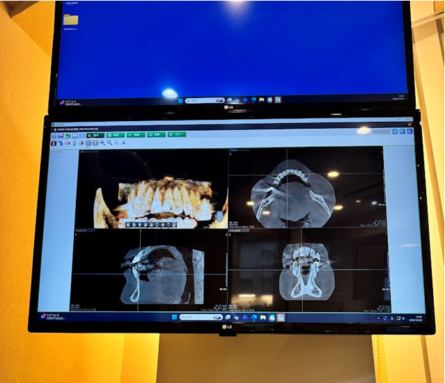 五反田エヌ・エイ歯科(歯科衛生士の求人)の写真4枚目:患者様の歯の健康を守るため、日々新しいことや物を取り入れています