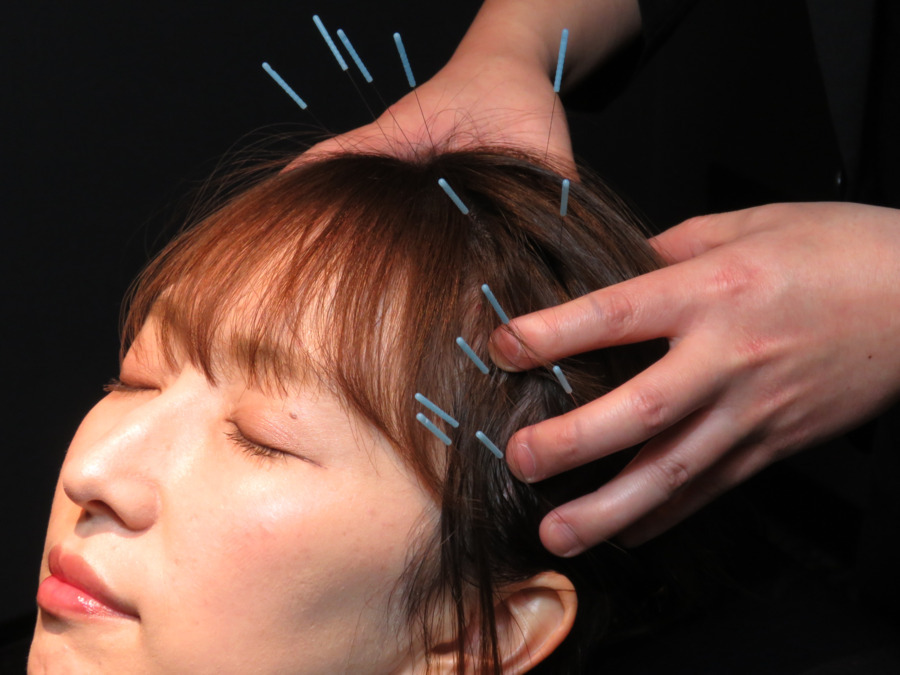 Revive-S（リバイブエス）　髪と肌の運命を変える鍼灸サロンの写真8枚目：