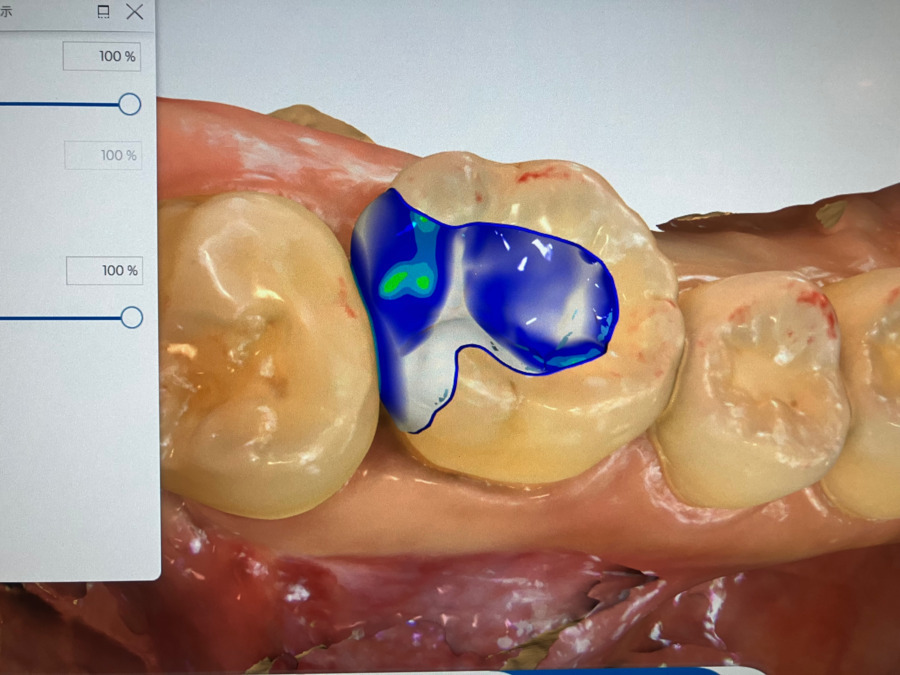 印西森のはいしゃさん(歯科衛生士の求人)の写真6枚目: