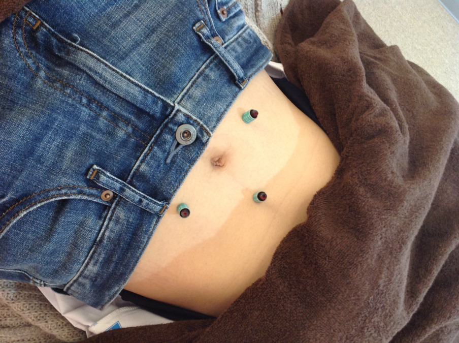 しおり針灸院の写真3枚目: