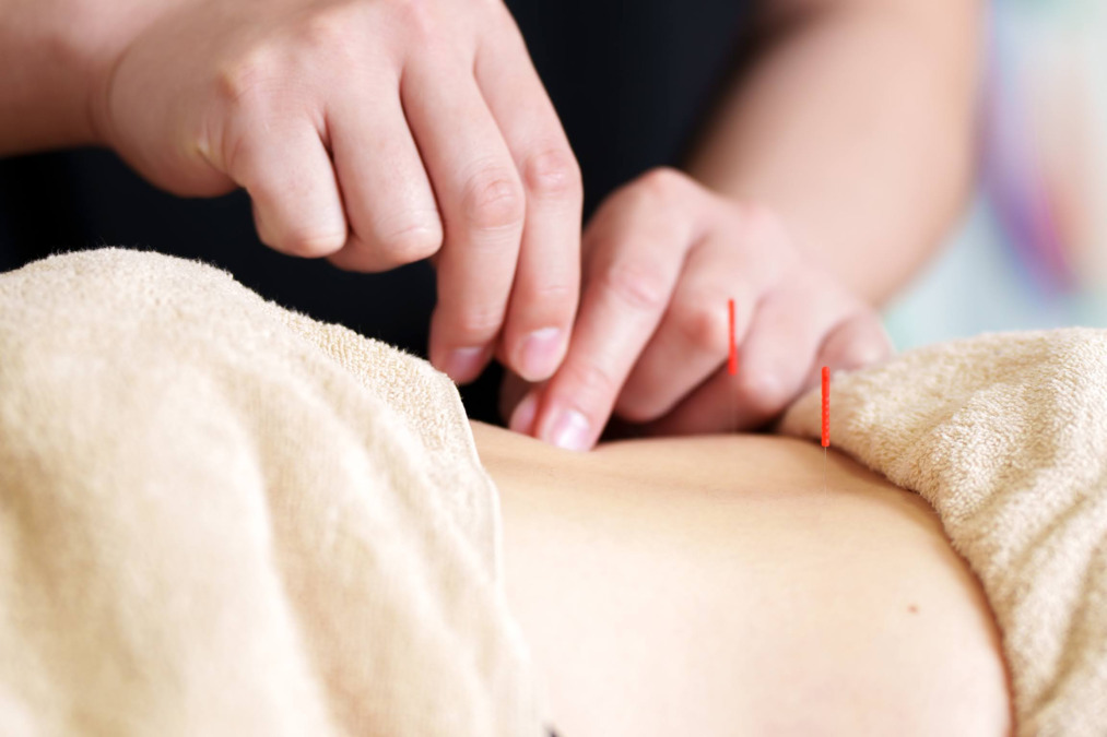 まさゆき鍼灸整骨院（柔道整復師の求人）の写真3枚目：