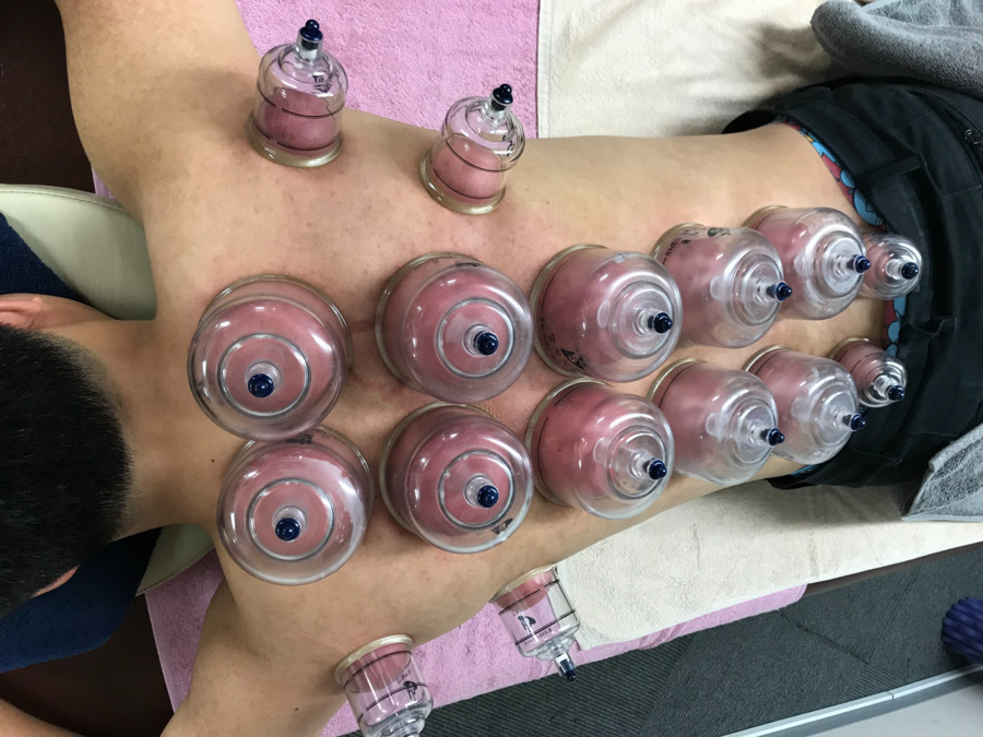 永信堂整骨院　関原院（鍼灸師の求人）の写真4枚目：