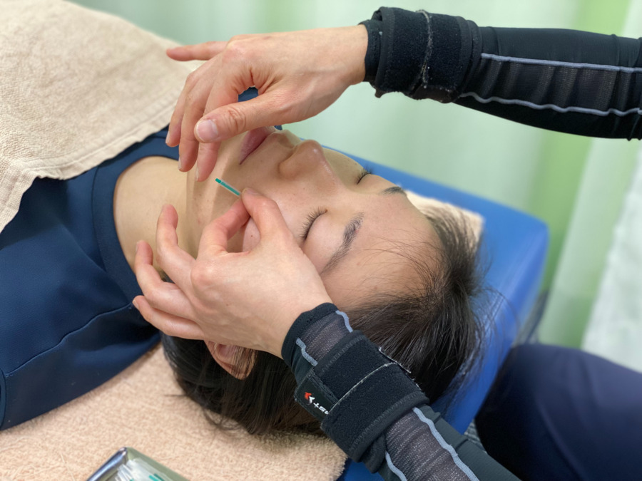 キューポラ接骨鍼灸院の写真5枚目：