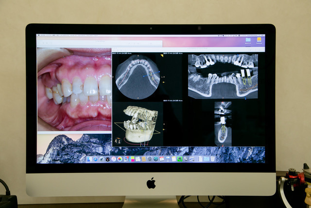 あい歯科の写真5枚目：