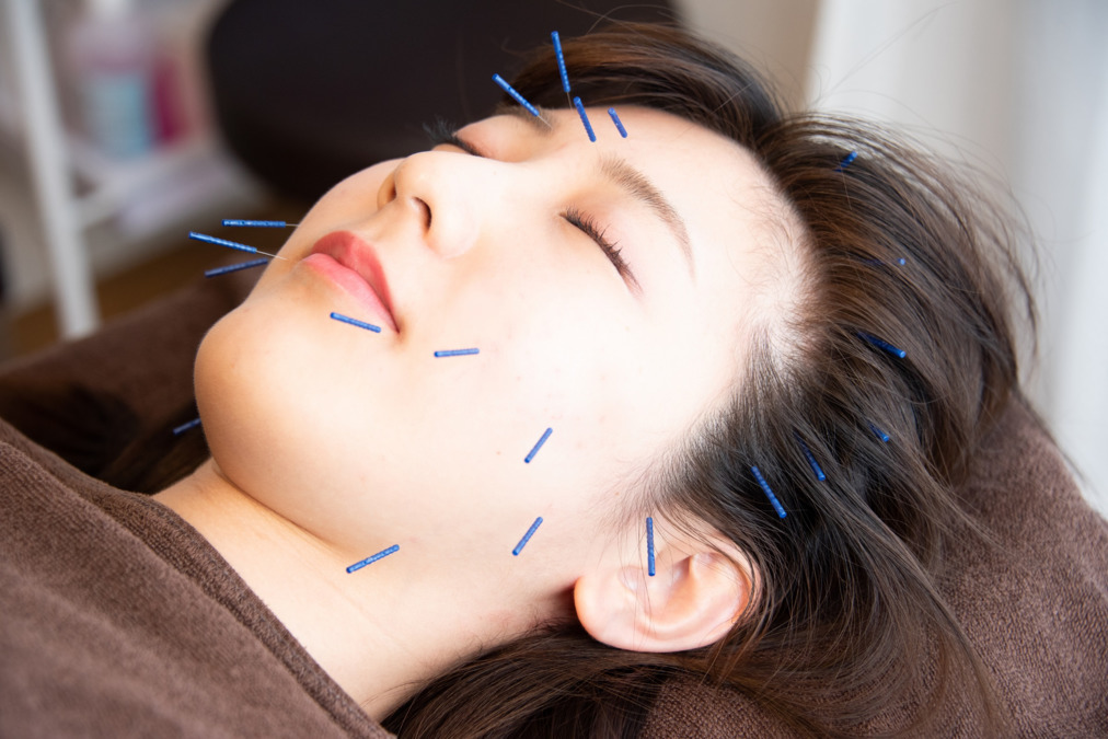 八木鍼灸院・八木整骨院(鍼灸師の求人)の写真8枚目: