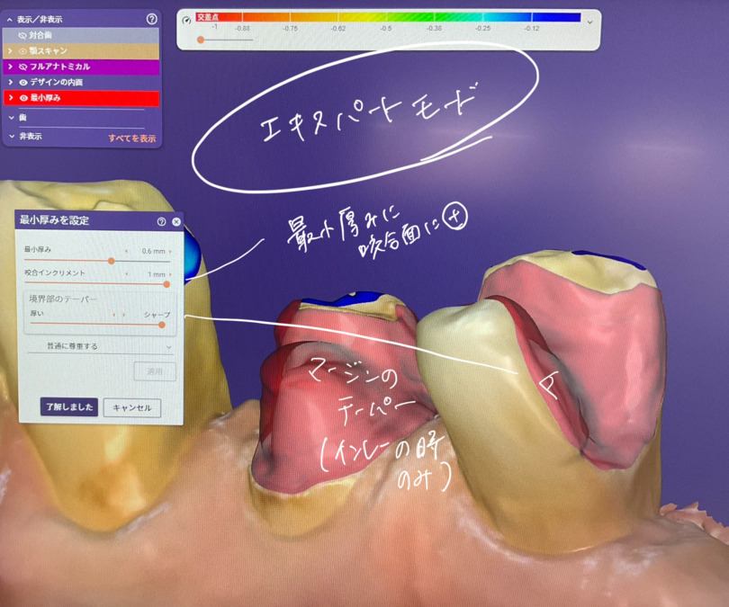 のぶ歯科・歯ならび歯科(歯科技工士の求人)の写真2枚目: