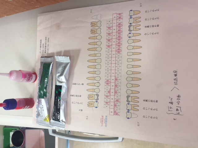 よしの歯科医院（歯科衛生士の求人）の写真3枚目：