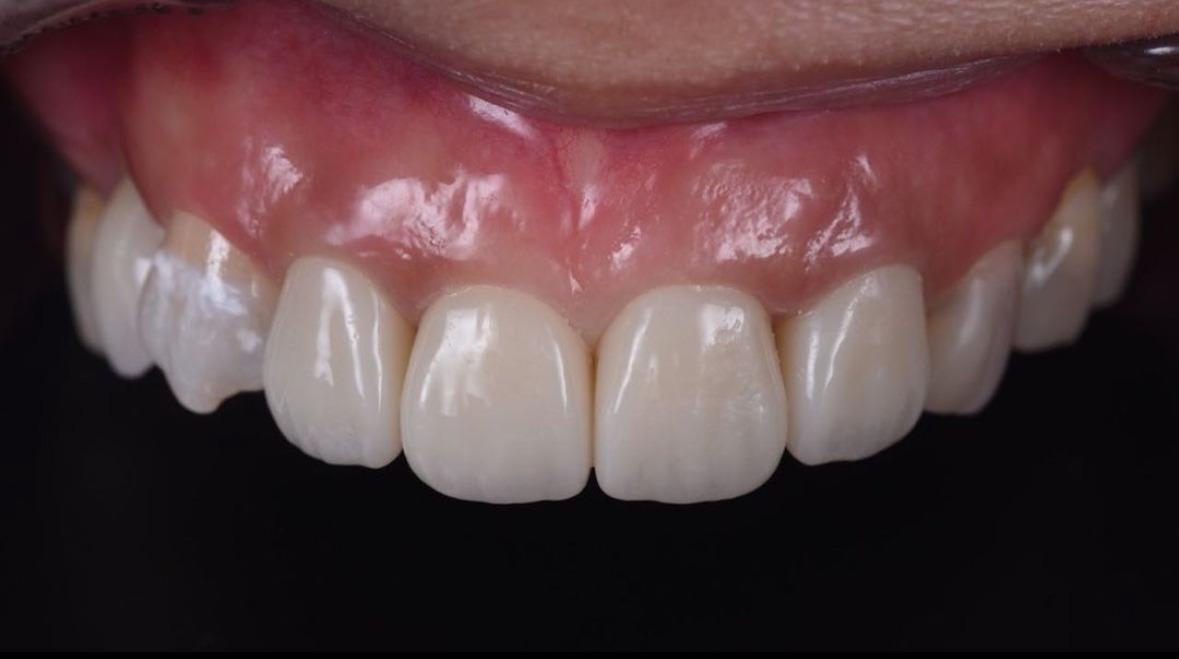 株式会社Lea ceramic worksの写真3枚目：