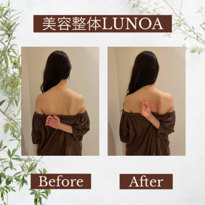美容整体LUNOA 新宿三丁目院【2025年09月12日オープン】（整体師の求人）の写真12枚目：