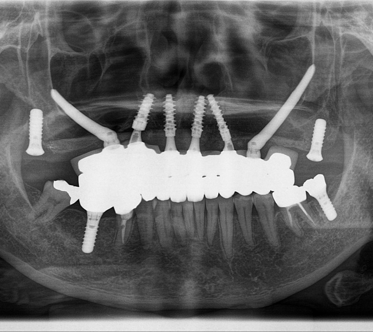 北梅田インプラントオフィスの写真8枚目: