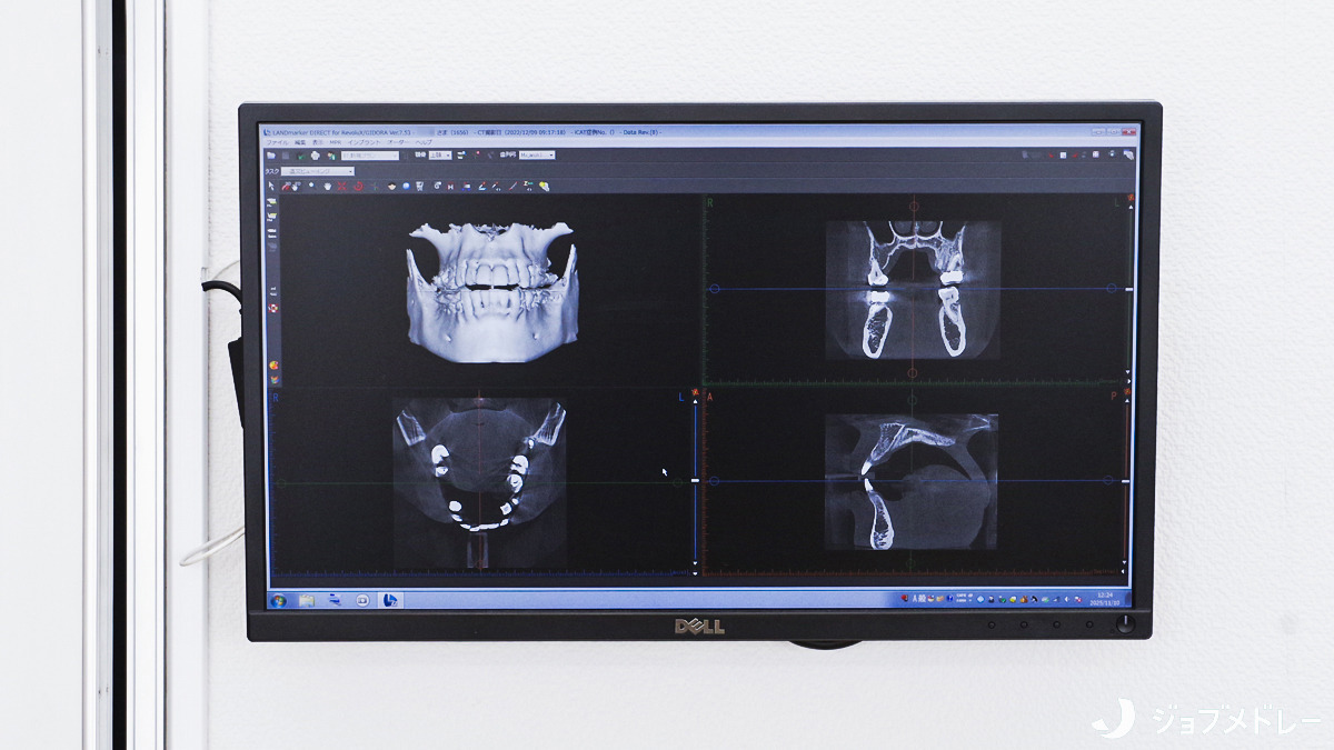 三上歯科医院（歯科衛生士の求人）の写真12枚目：画像を用いたわかりやすい説明を行っています