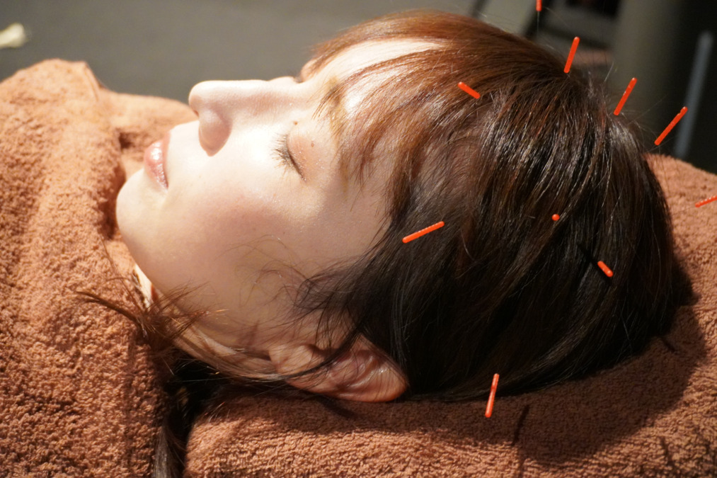 Revive-S（リバイブエス）　髪と肌の運命を変える鍼灸サロンの写真3枚目：