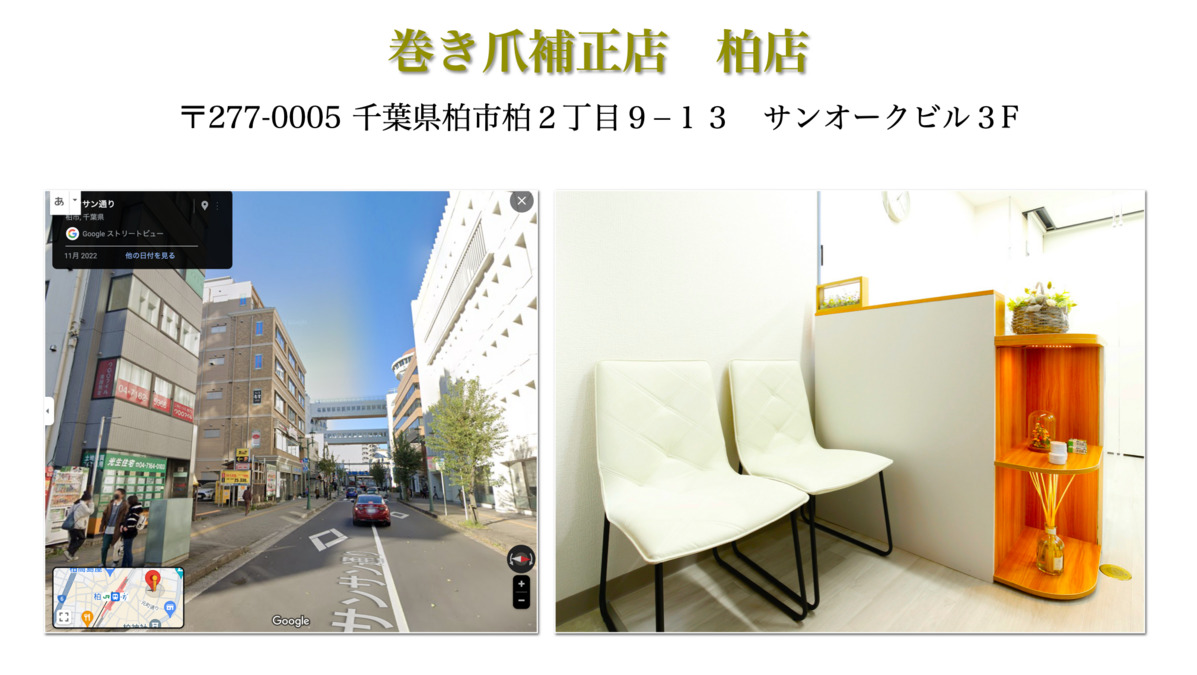 巻き爪補正店 柏店の写真7枚目：