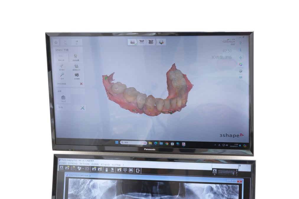 おおもり北口歯科（歯科衛生士の求人）の写真10枚目：