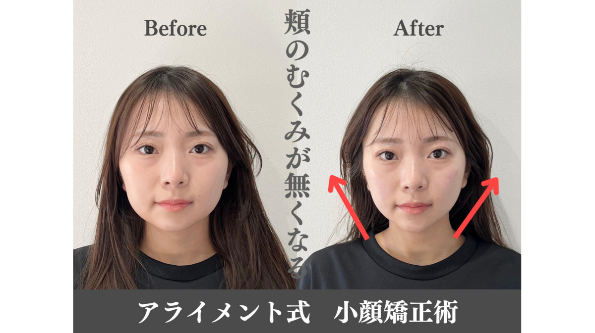 美容整体 AlignmentTOKYO 表参道【2024年11月オープン】（鍼灸師の求人）の写真5枚目：