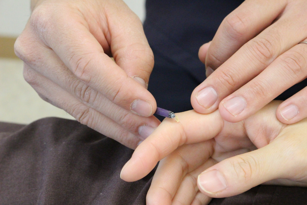 くにさだ鍼灸整骨院（鍼灸師の求人）の写真19枚目：きゅう師としてもしっかり仕事をしていきます。