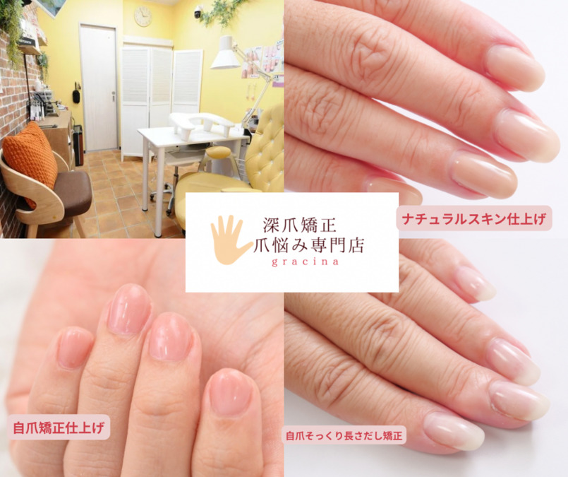 グレースレディの写真