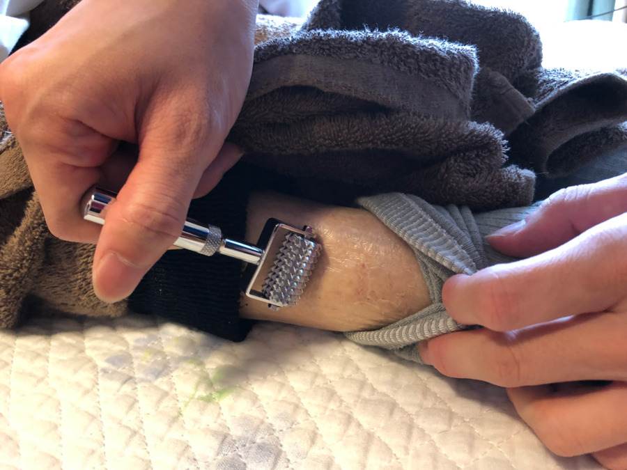 さざん訪問鍼灸サービス（鍼灸師の求人）の写真2枚目：