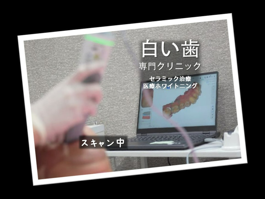 ３Dスキャンデンタル東京の写真7枚目：