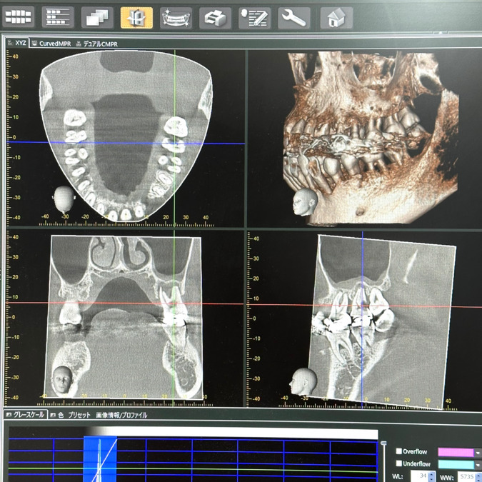 弘部歯科クリニックの写真5枚目：