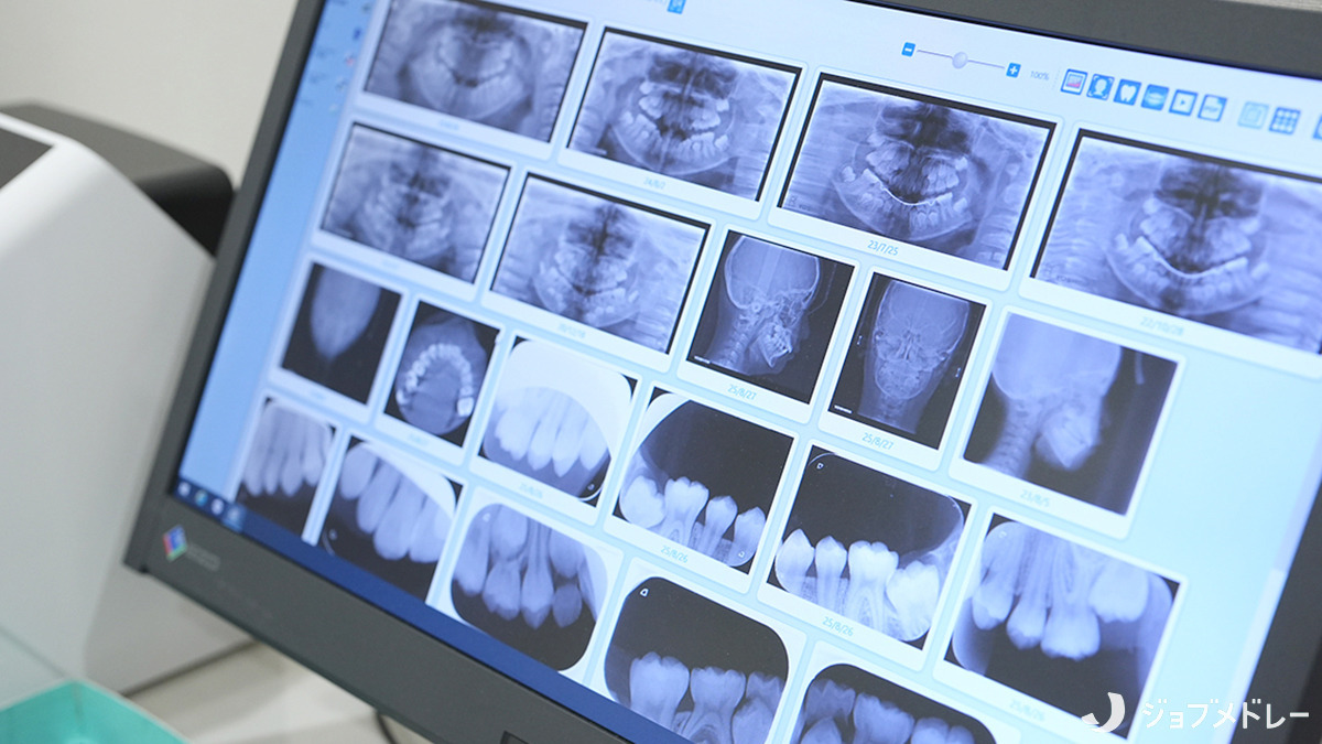 小岩井歯科（医療事務/受付の求人）の写真27枚目：精密な画像を用いて正確な診断に努めています