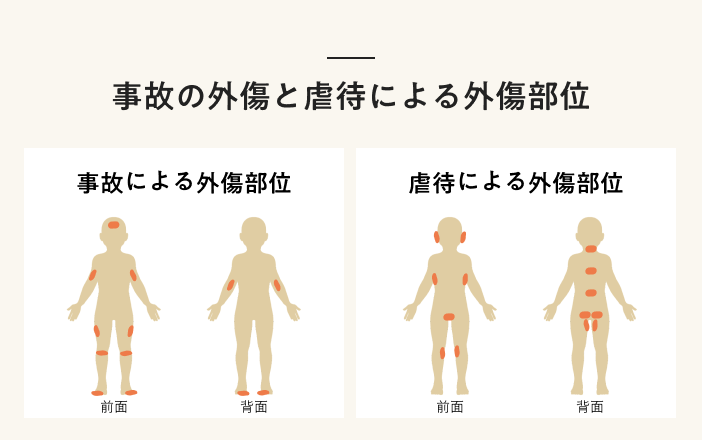 子ども虐待の身体所見 Amazon.co.jp: 子ども虐待の身体所見 : クリストファー・J