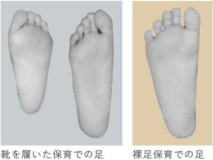 中里どろんこ保育園 足の発達の比較写真